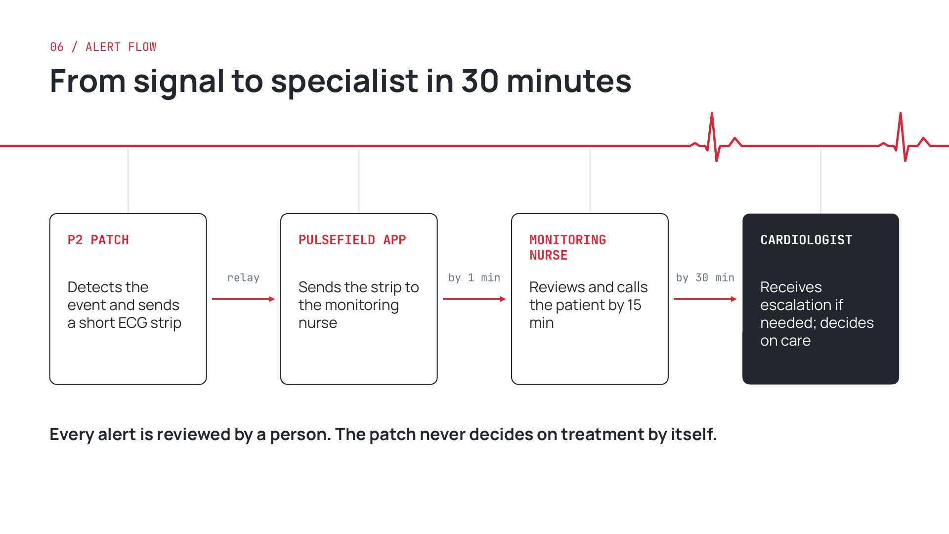 Pulsefield — The alert workflow